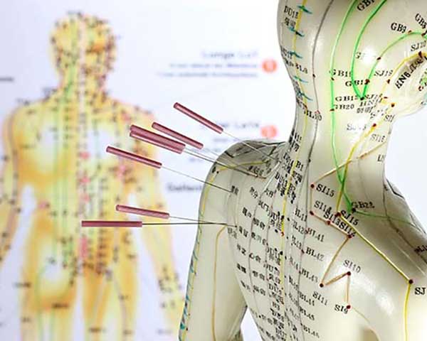 Akupunkturpunkte Körper