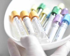 naturheilmedizin-vitamine-infusionen-labor Infusionsampullen in Schale